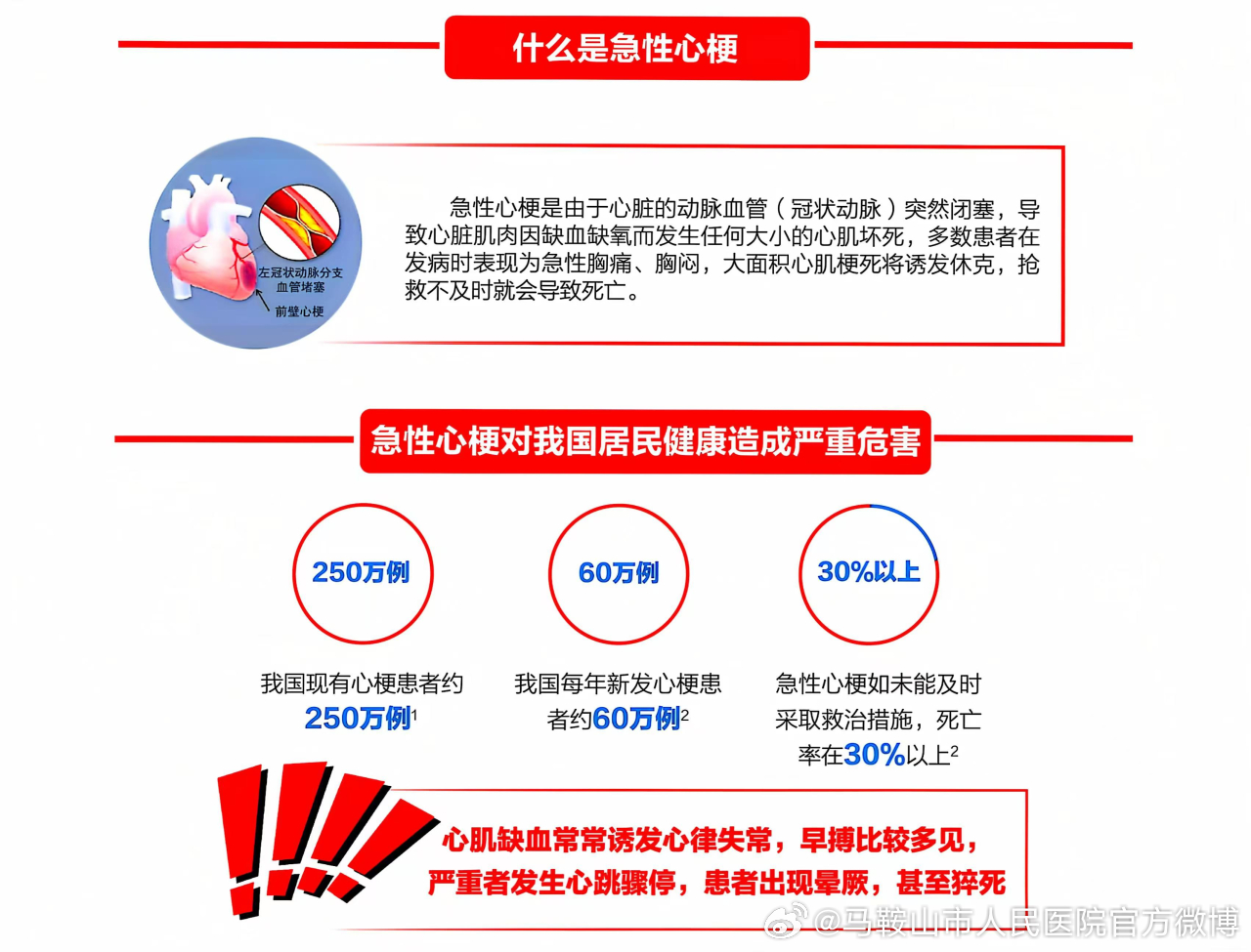 心梗最新进展揭秘🌟